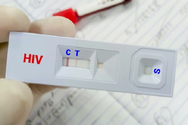 تغییر الگوی انتقال HIV در ایران؛ سهم اعتیاد تزریقی کاهش یافته است